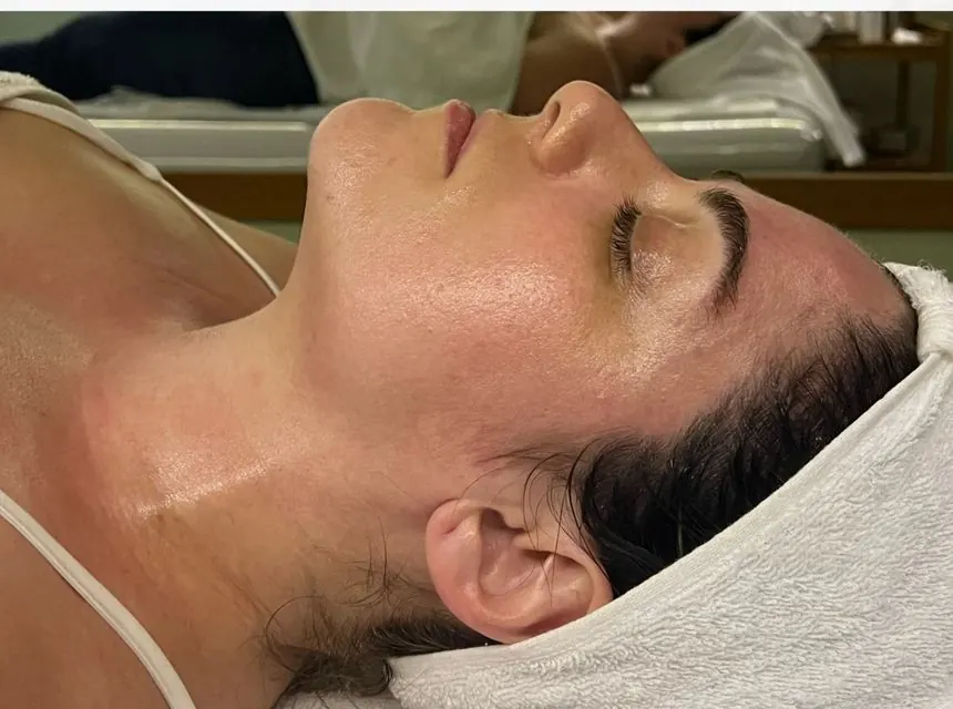 Depois — resultado facial